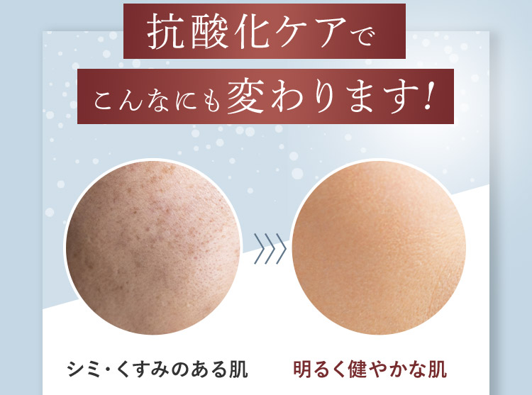 抗酸化ケアでこんなにも変わります！ シミ・くすみのある肌 明るく健やかな肌